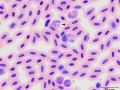 Plasmodium