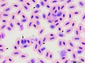 Plasmodium