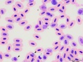 Plasmodium