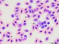 Plasmodium