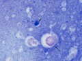 Ovum & Iodamoeba