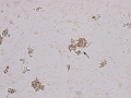 Agglutination