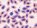 Immature RBC, lymphocyte & thrombocyte