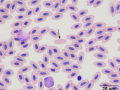 Erythroplastid