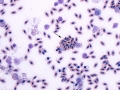 Agglutination