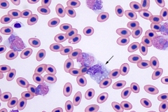 Avian WBC