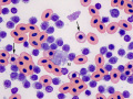 CLL (duck)