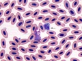 African gray parrot: Eosinophil & heterophil