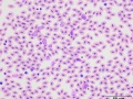 Turkey: Leukocytes