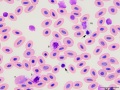 Turkey: Leukocytes