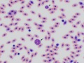 Hypersegmented heterophil (goose)