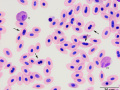 Turkey: Heterophil & Eosinophil