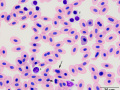 Turkey: Granular lymphocyte