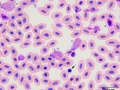 Turkey: Leukocytes