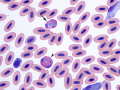 Hawk: Heterophil & eosinophil