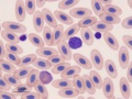 Hawk: Heterophil & lymphocyte
