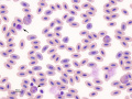 Hawk: Heterophil, eosinophil, & basophil