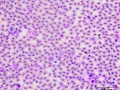 Turkey: Leukocytes