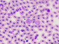 Turkey: Leukocytes