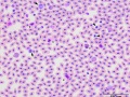 Turkey: Leukocytes