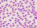Turkey: Leukocytes
