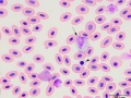 Turkey: Leukocytes
