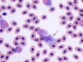 Heterophil & monocyte