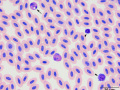 Motmot: Leukocytes