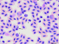 Parrot: Leukocytosis