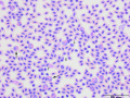 Parrot: Leukocytosis