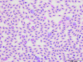 Parrot: Leukocytosis