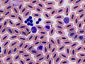 Whistling duck: Leukocytes