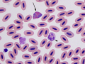 Whistling duck: Leukocytes