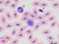 Myelocyte & azurophil