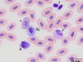 Band heterophil, reactive lymphocyte & azurophil