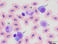 Heterophils & reactive lymphocytes