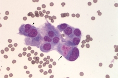Bladder