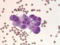 Urothelial carcinoma (DQ, cat)