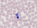 Apoptotic WBC