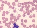 Bacteria