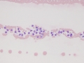 Endothelial cells