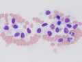 Endothelial cells