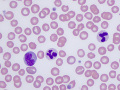 Fresh blood