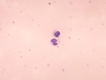 Hemolyzed RBC