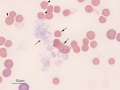 Water artifact, Mycoplasma haemofelis, degranulated platelets