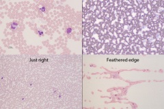 Blood smear features
