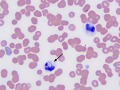 Bacilli in a neutrophil
