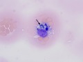 Bile cast in a macrophage