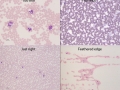 Compilation of different areas of the smear