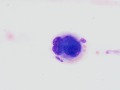 Megakaryocyte